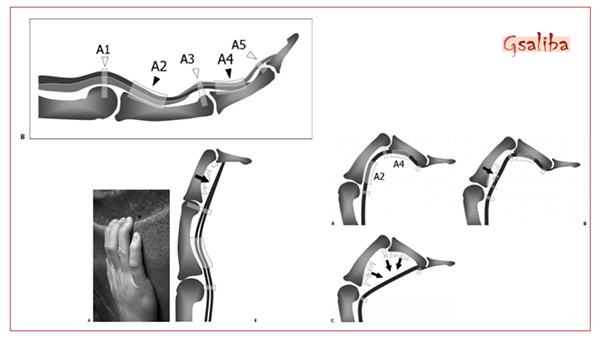 Saúde: as mãos do escalador